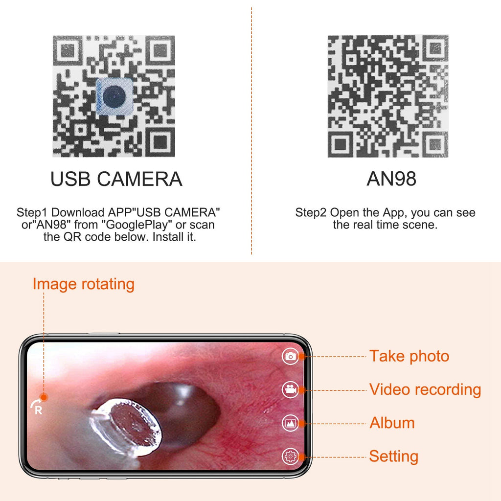 Ear Endoscope Wax Remover